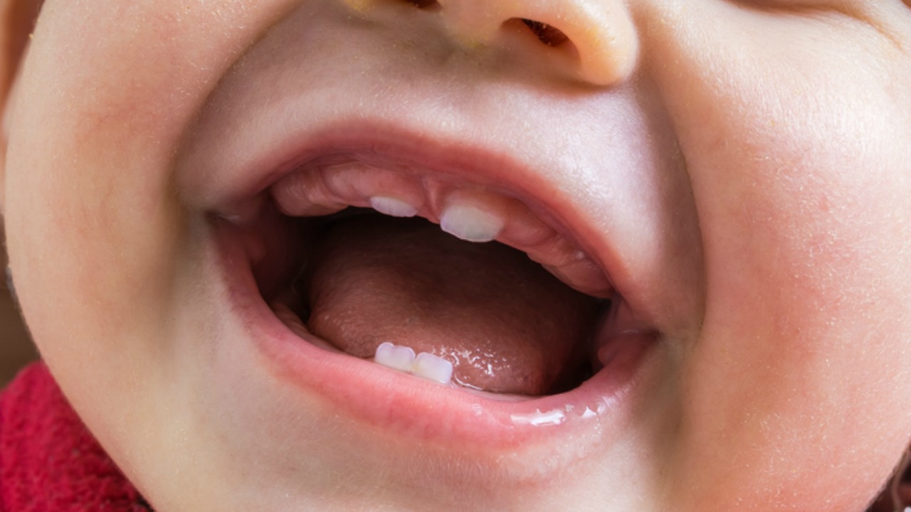 Niektóre noworodki rodzą się z zębami